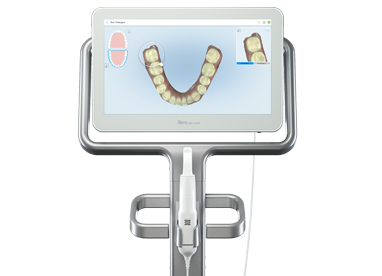 3D Intraoral Scanner